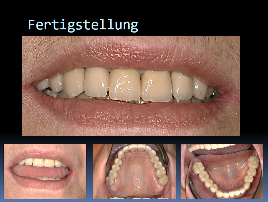 Abschluß